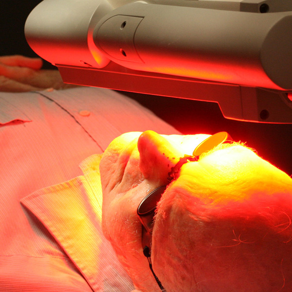 PDT photodynamic therapy